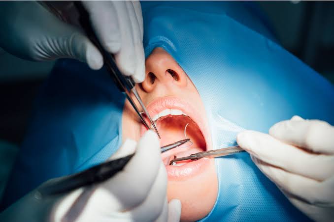 Oral Surgery